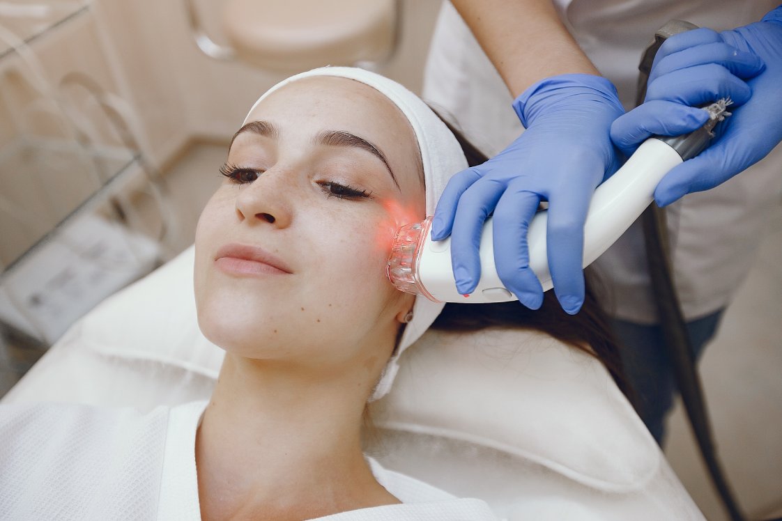 MNRF Treatment