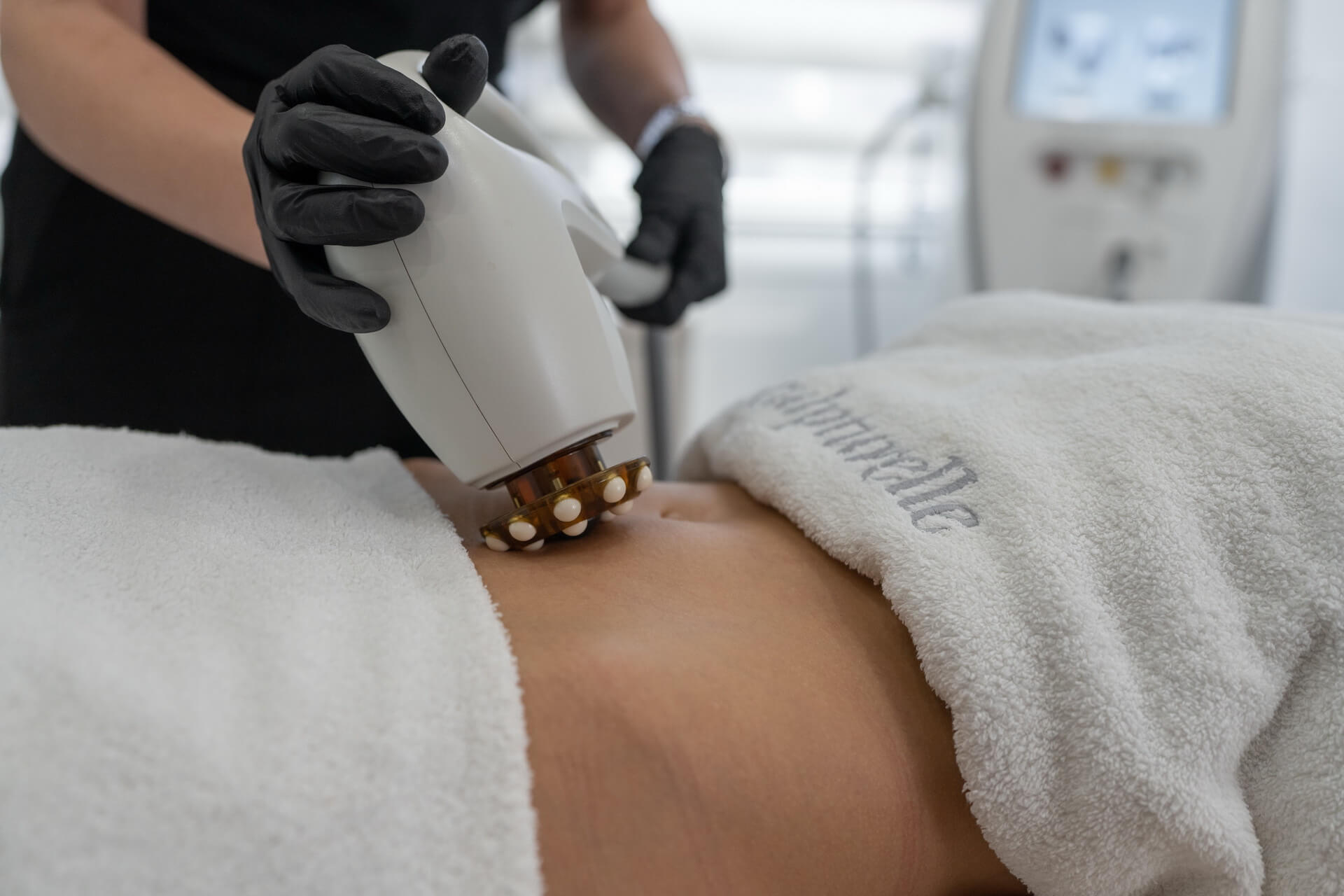 Stretch Marks Reduction