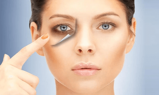 Undereye Treatment