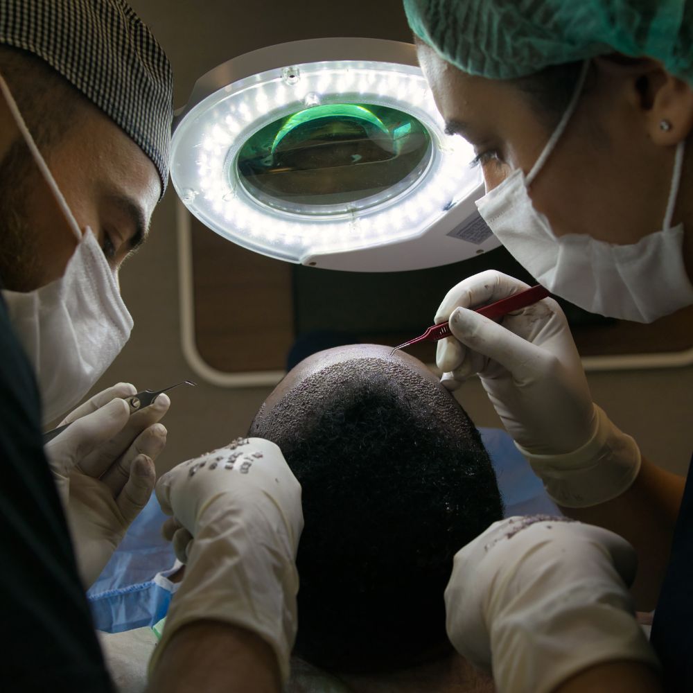 hair transplant 1