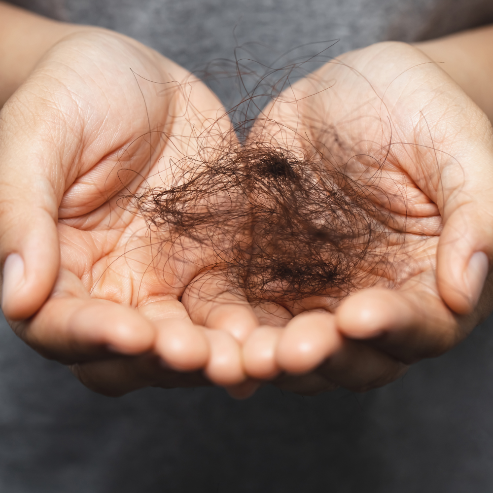 hairfall 3